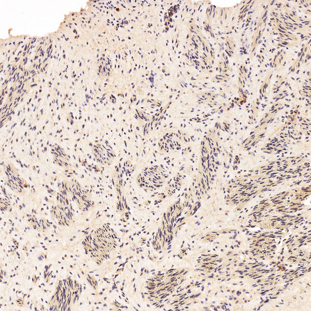 sars-cov-2 gene expression in a human fetus